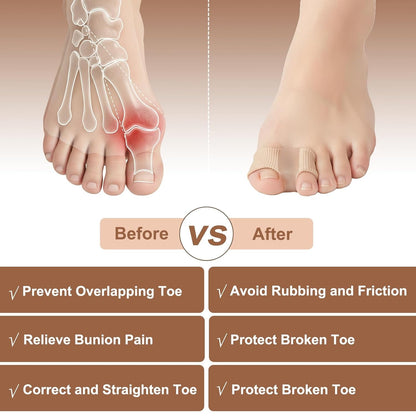 Universal Gel Bunion Toe Separators - Relieve Foot Pain, Overlapping Toes