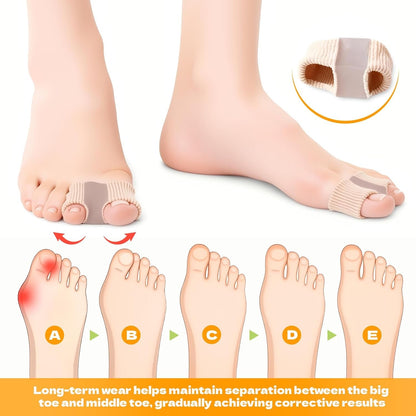 Universal Gel Bunion Toe Separators - Relieve Foot Pain, Overlapping Toes