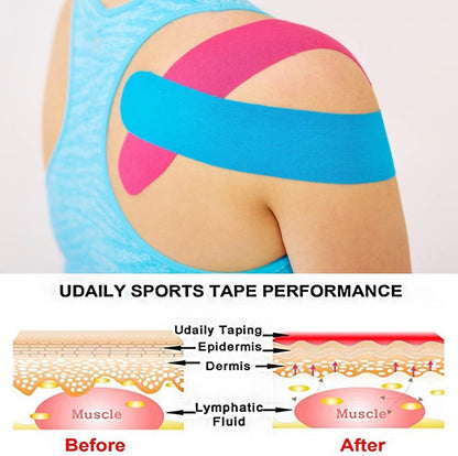 Pre-Cut Professional  Sports Kinesiology Tape, Athletic Tape, Breathable Elastic Waterproof Muscle Support Straps, Flexible Durable